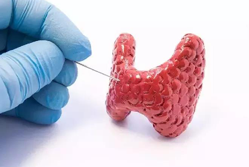 甲状腺疾病，包括甲状腺功能减退和甲状腺功能亢进，自古以来就是反复被医学研究人员研究的疾病